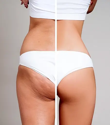 Vibro Shape